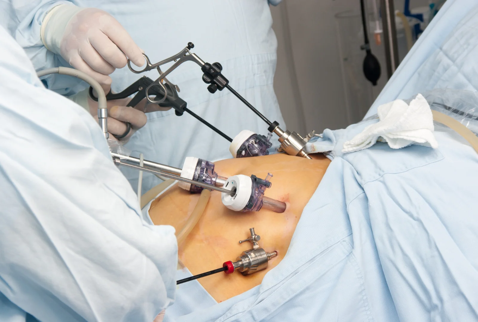 Laparoscopic Surgery-IMG