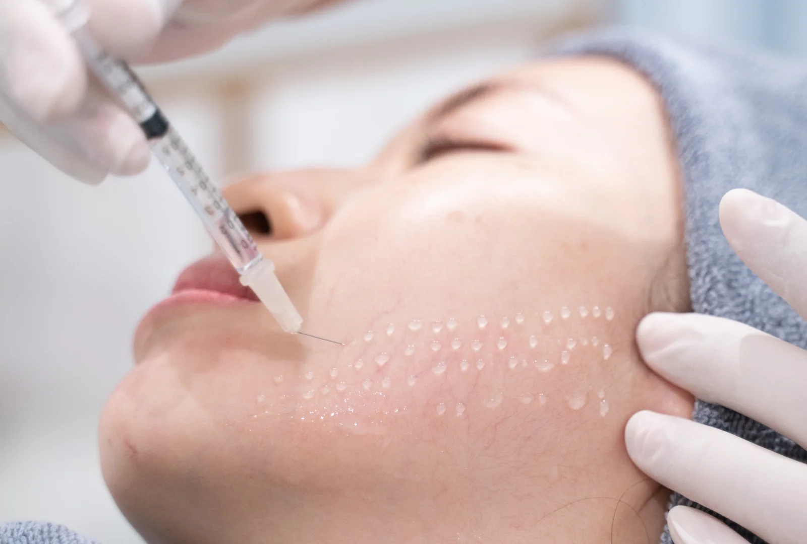Mesotherapy-IMG
